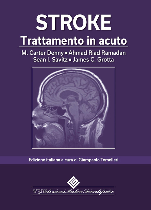 Stroke. Trattamento in acuto