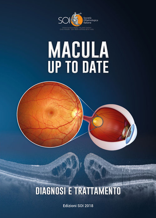 Macula up to date. Diagnosi e trattamento