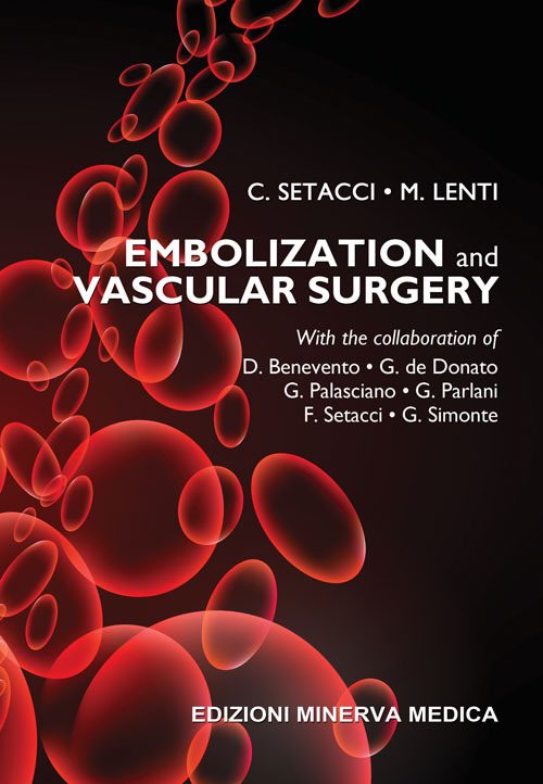 Embolization and vascular surgery