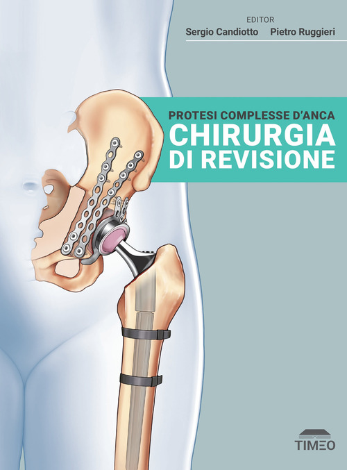 Protesi complesse d'anca. Chirurgia di revisione