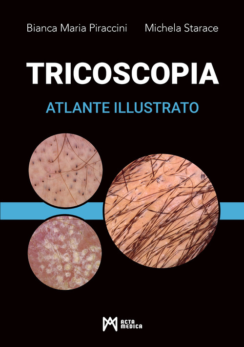 Tricoscopia. Atlante illustrato