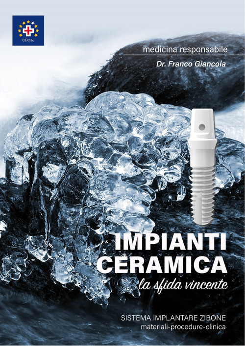 Impianti ceramica. La sfida vincente. Sistema implantare Zibone