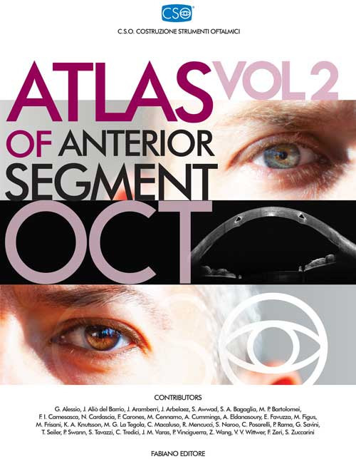Atlas of anterior segment oct