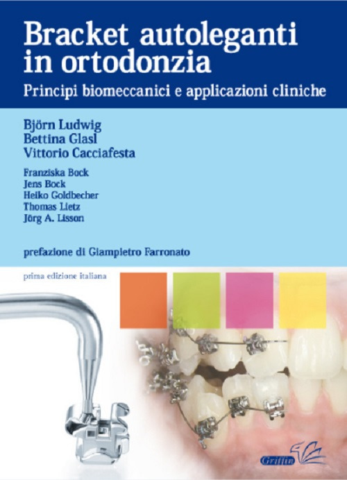 Bracket autoleganti in ortodonzia. Principi biomeccanici e applicazioni cliniche