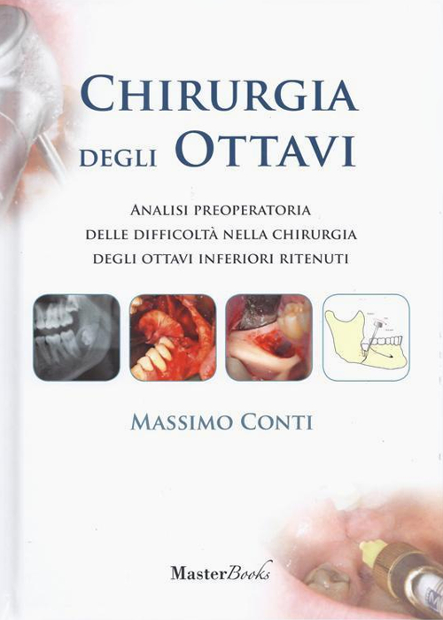 Chirurgia degli ottavi. Analisi preoperatoria delle difficolt&agrave; nella chirurgia degli ottavi inferiori ritenuti