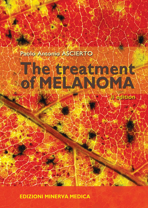 The treatment of melanoma