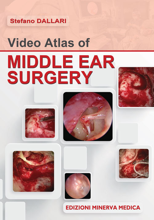 Video atlas of middle ear surgery