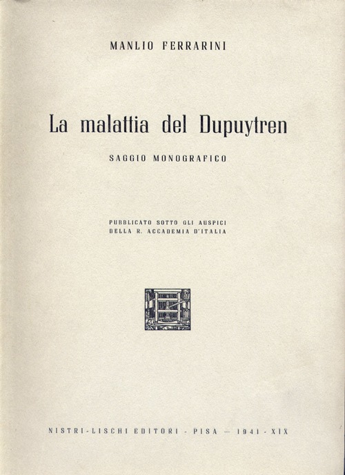 La malattia del Dupuytren
