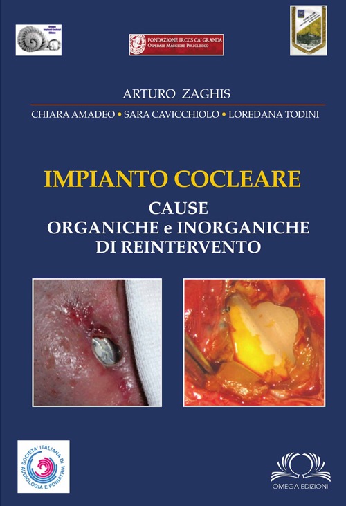 Impianto cocleare. Cause organiche e inorganiche di reintervento