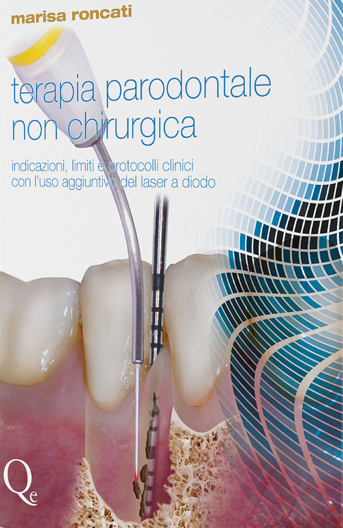 Terapia parodontale non chirurgica. Indicazioni, limiti e protocolli clinici con l'uso aggiuntivo del laser a diodo