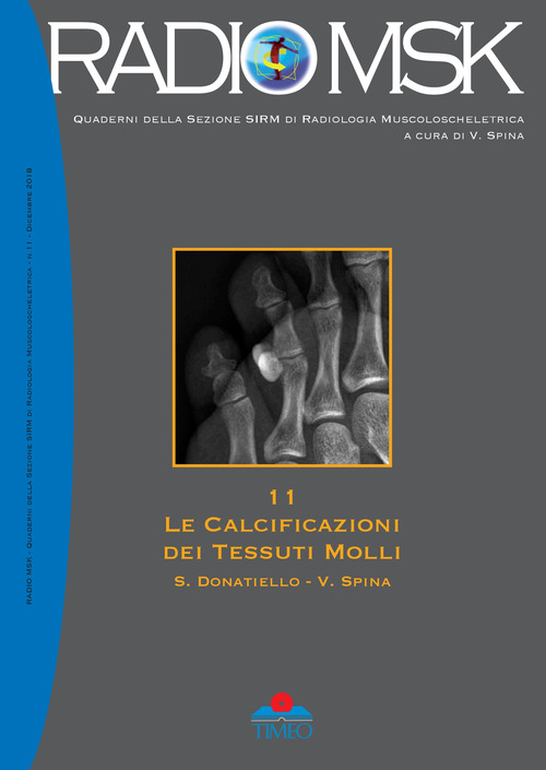 Le calcificazioni dei tessuti molli