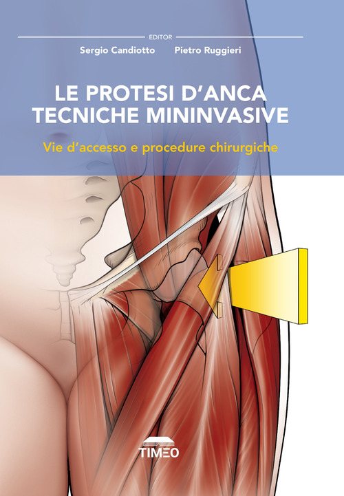 Le protesi d'anca. Tecniche mininvasive. Vie d'accesso e procedure chirurgiche